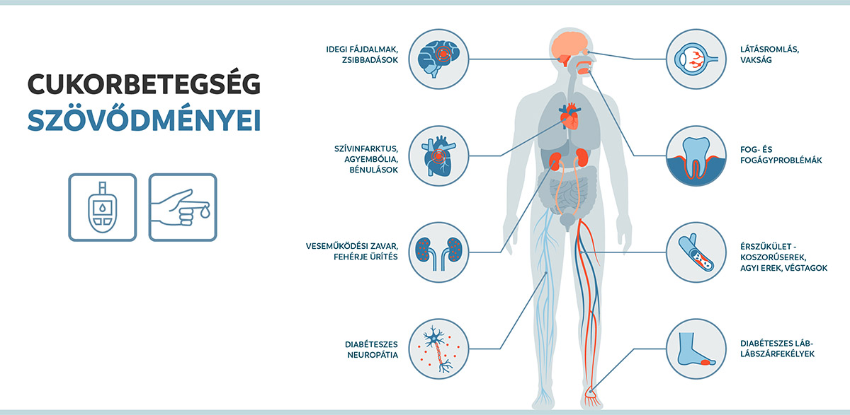 Cukorbetegség szövődményei